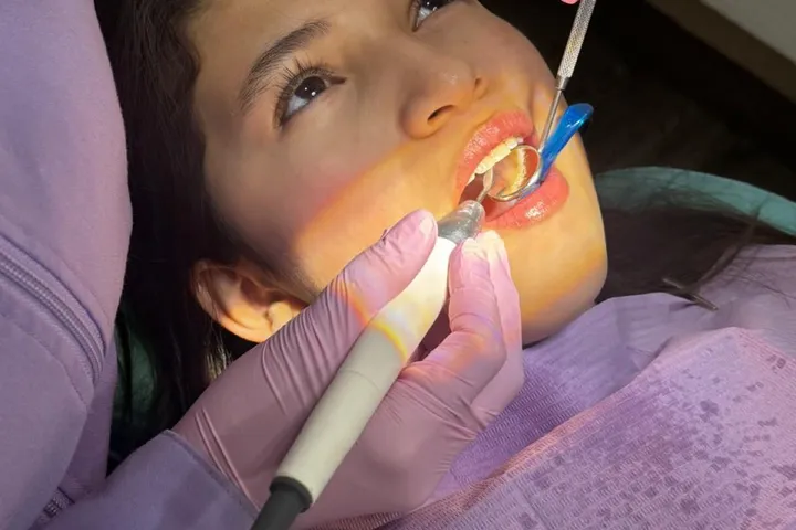 Paciente recibiendo una limpieza dental profesional